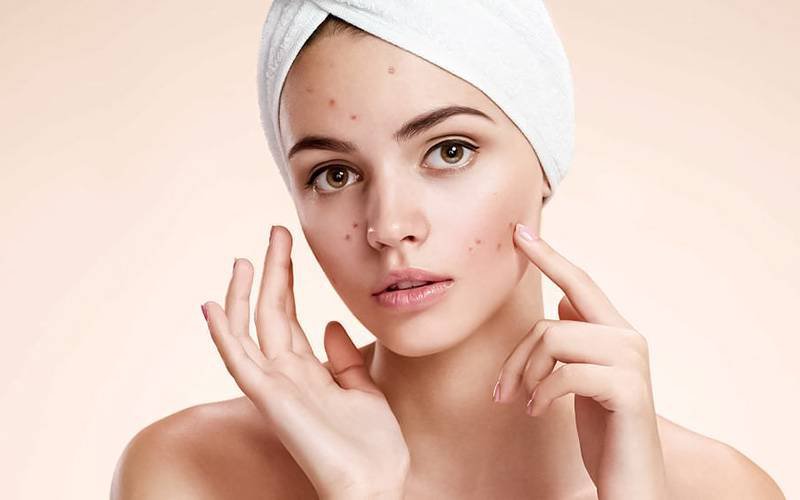 Nova descoberta pode levar a novos tratamentos contra acne