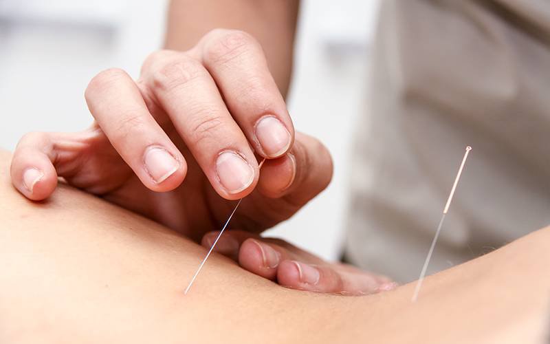Agulhas de acupuntura porosas produzem melhores resultados terapêuticos