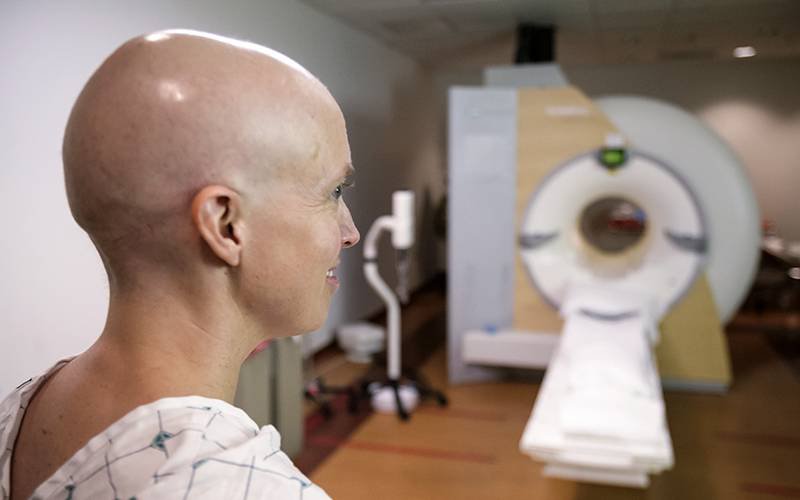 Quimioterapia direta no cérebro mais eficaz do que fármacos sistémicos