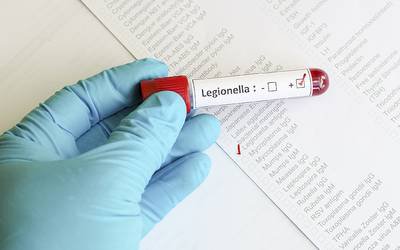 Aumenta para onze número de doentes com Legionella no hospital CUF