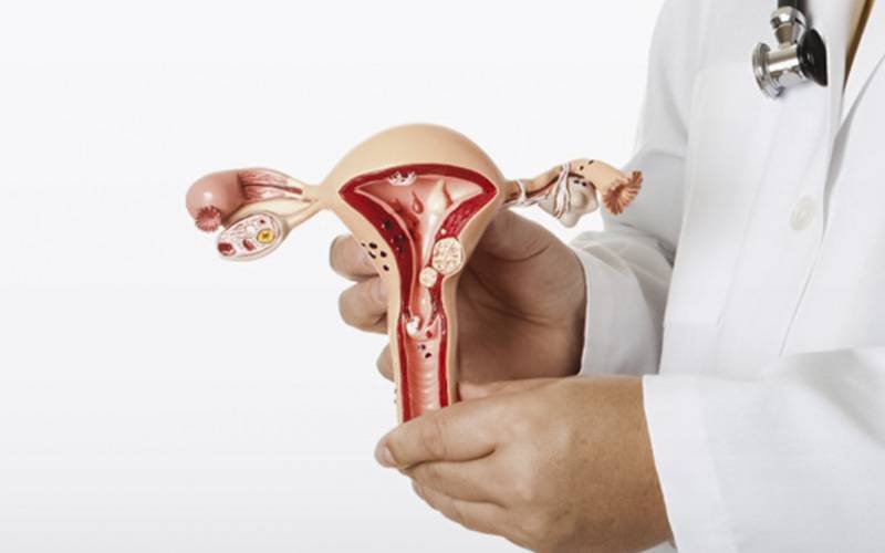 Endometriose afeta uma em cada dez mulheres no mundo