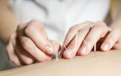 Investigadores questionam eficácia da acupuntura