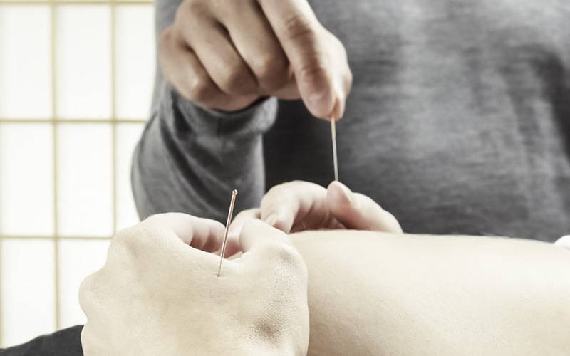 Estudos apontam para benefícios da acupuntura na gestação