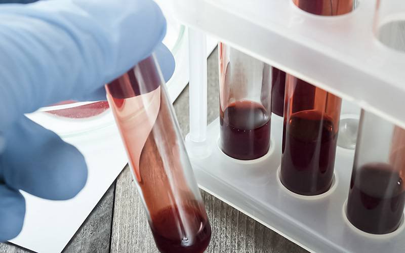 Teste de sangue para deteção de células precursoras de cancro
