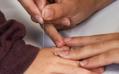 Conheça seis benefícios da acupuntura aplicada às crianças