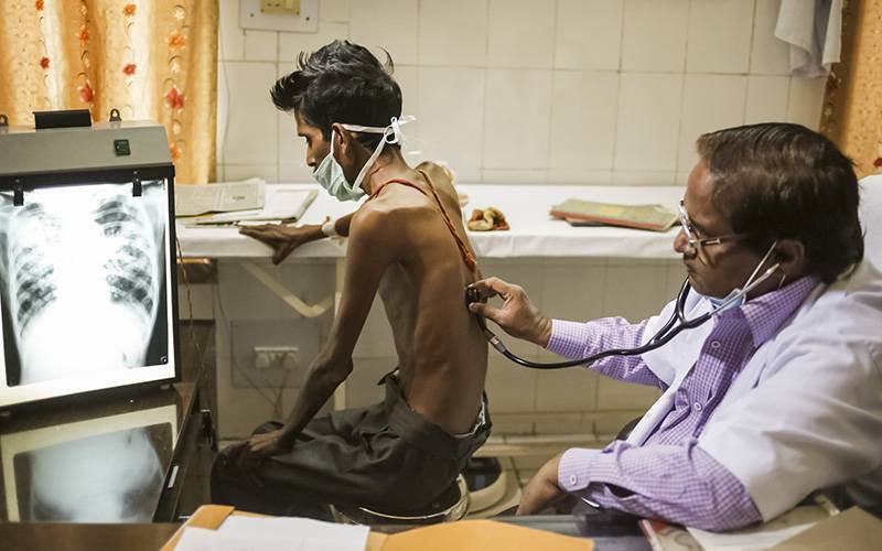 Tuberculose matou 1,3 milhões de pessoas em 2017