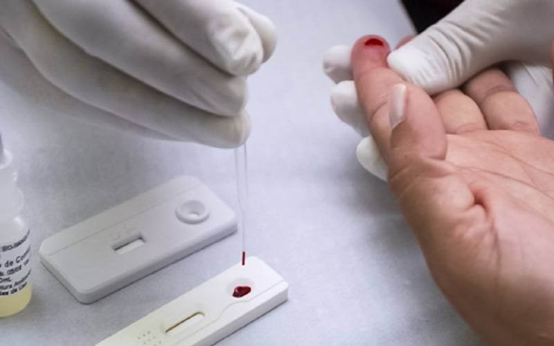 Farmácias de Cascais já realizam testes do VIH/SIDA e hepatite