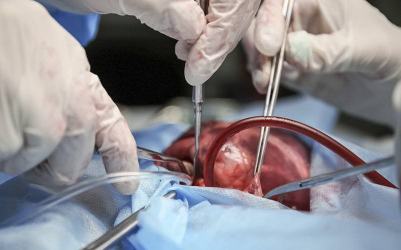 Há falta de dadores para transplantação cardíaca em Portugal