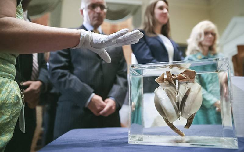 Primeiro coração artificial começou a “bater” há 50 anos