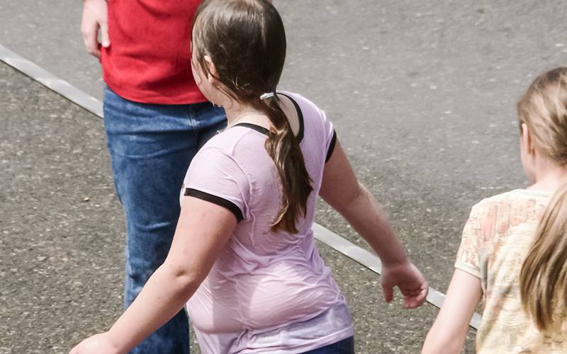Obesidade associada ao aumento de risco de esclerose múltipla