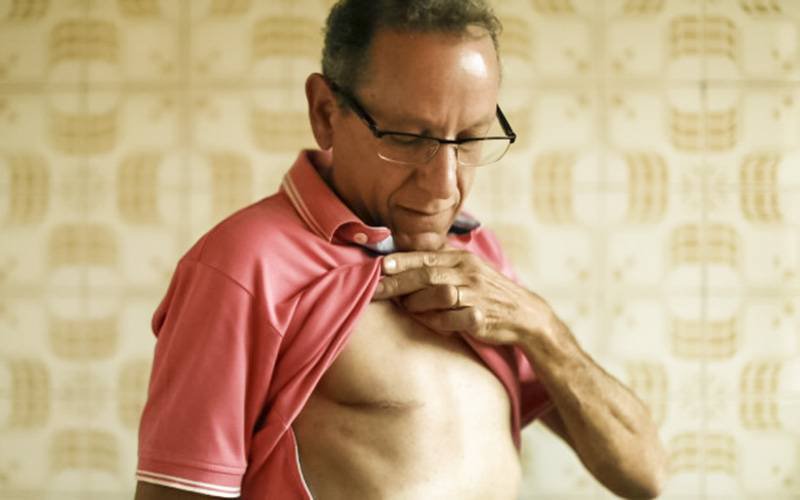 Homens representam 1% dos casos de cancro da mama no Brasil