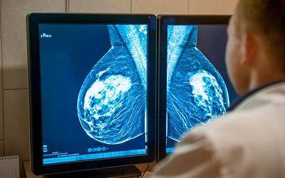 Identificada assinatura genética relacionada com o cancro da mama