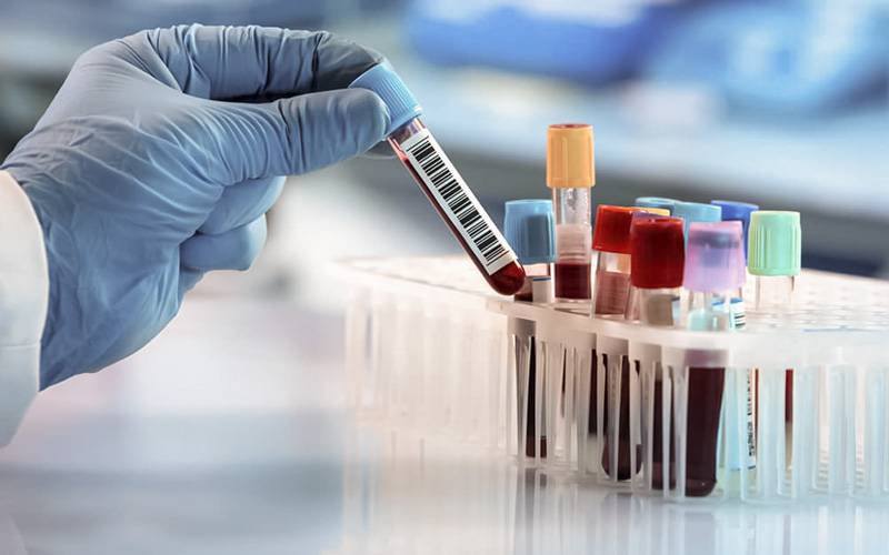 Teste sanguíneo avalia proteínas que revelam idade