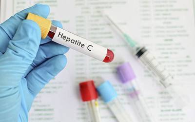 Tratamento da hepatite C mais eficaz do que o esperado