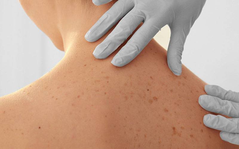 Método inovador e sensível à luz poderá tratar doenças da pele