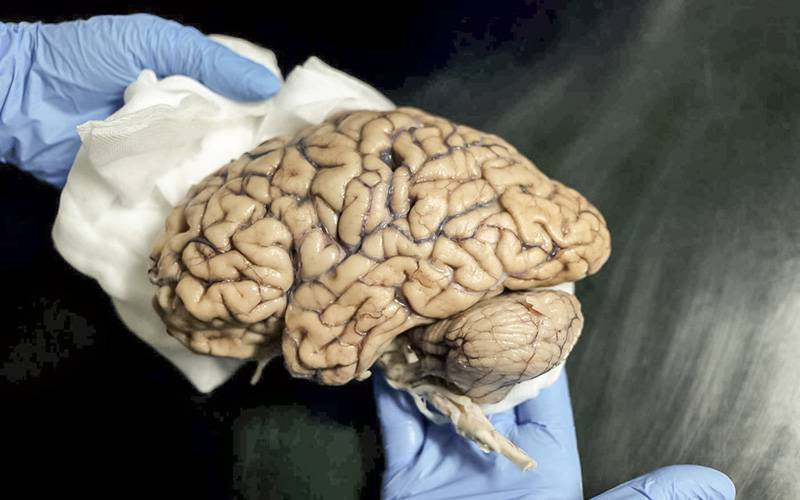 Único banco português de cérebros tem cerca de 60 exemplares