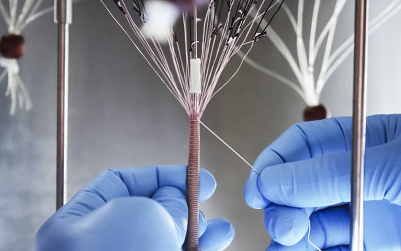 Técnica inovadora pode criar vasos sanguíneos em laboratório