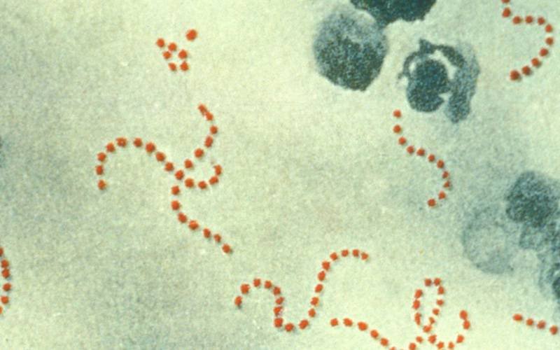 Descobertas sobre bactéria ajudam no combate à infeção puerperal