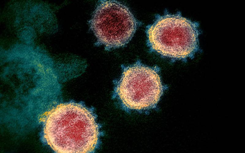 Novo coronavírus é viável por até três dias em alguns materiais