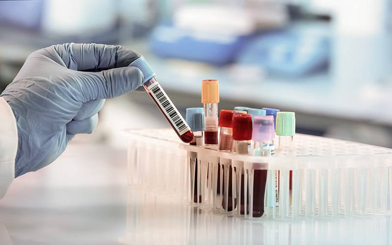 Criado exame de sangue que deteta mais de 50 tipos de cancro