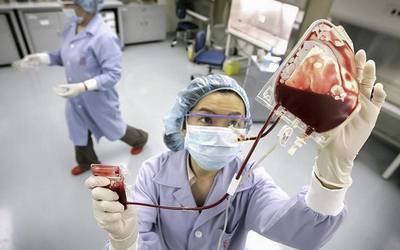 Transplante autólogo de sangue eficaz na anemia aplástica grave