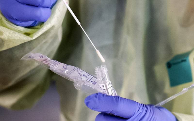 EUA aprovam primeiro teste rápido de antígeno para COVID-19