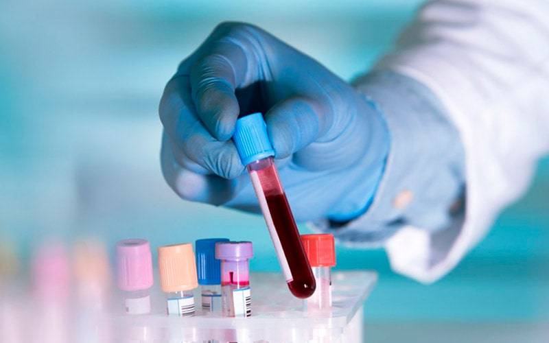 Exame de sangue simples pode detetar Alzheimer