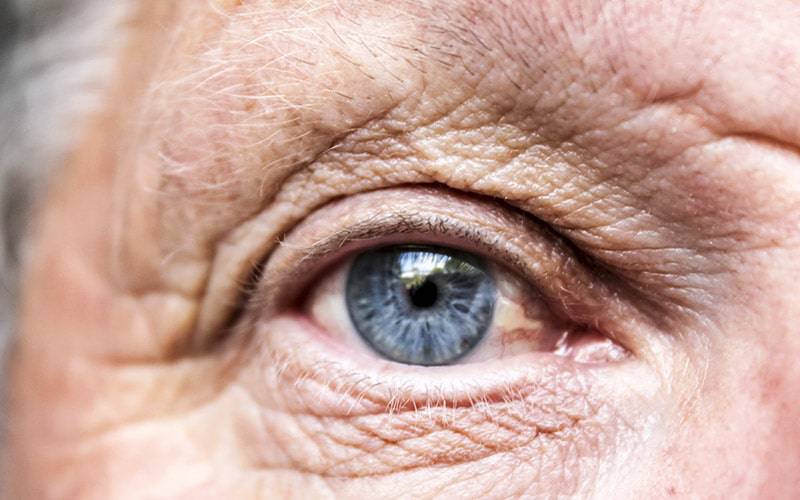 Textura da retina pode ser biomarcador de Alzheimer
