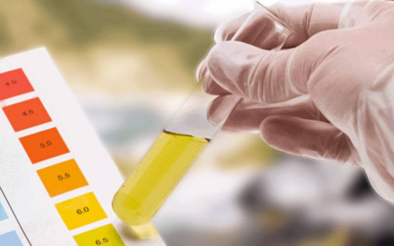 Exame de urina identifica cálculo renal em 30 minutos