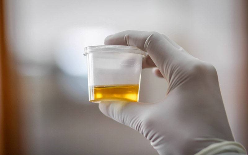Teste de urina pode revelar dados sobre a qualidade da dieta