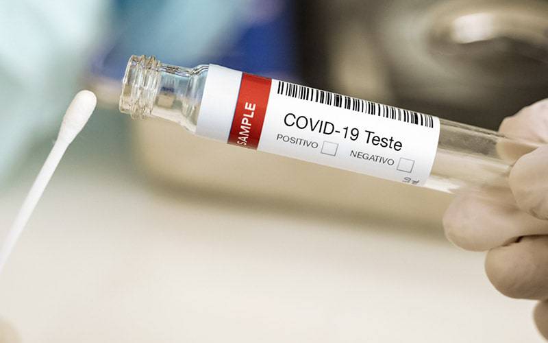 Testes à COVID-19: ADSE comparticipa antes de cirurgias
