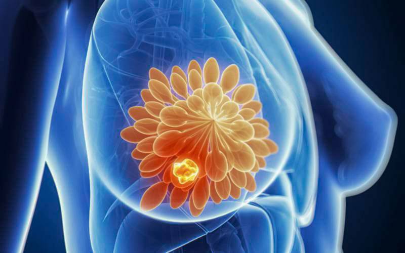 Jejum pode favorecer terapia do cancro da mama