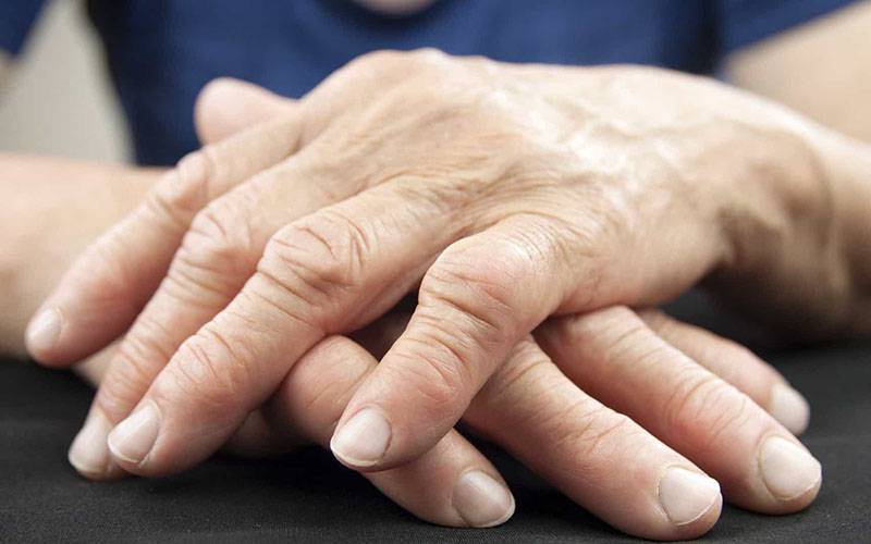 Polifenois podem ser úteis no tratamento da artrite reumatoide