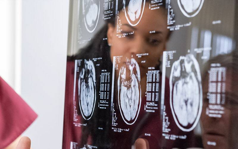UC integra estudo pioneiro que aprofunda cartografia do cérebro