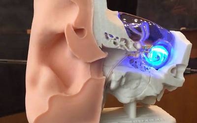 Implante coclear de luz restaura audição em cobaias