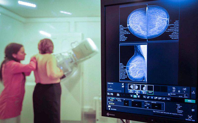 Projeto inovador quer tornar diagnóstico do cancro 100% digital