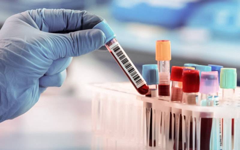 Cruz Vermelha disponibiliza 500 mil testes rápidos de antigénio