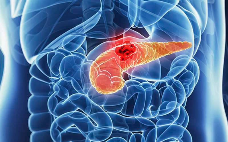 Cancro do pâncreas: “Está na hora” de fazer o diagnóstico precoce