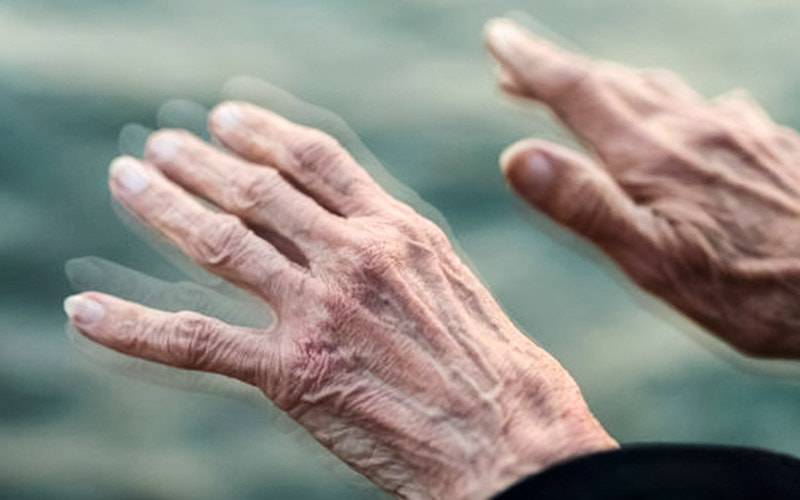 Teste de pele pode identificar doença de Parkinson