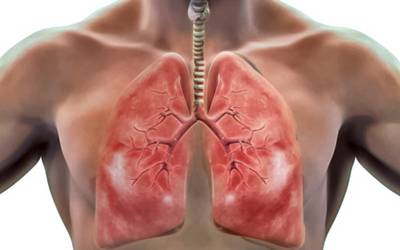 Vitamina U pode beneficiar saúde pulmonar