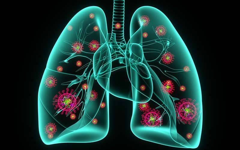 COVID-19: há sinais de que o vírus se está a espalhar aos pulmões