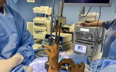 Artroscopia do punho: ULS Nordeste realiza cirurgia menos invasiva