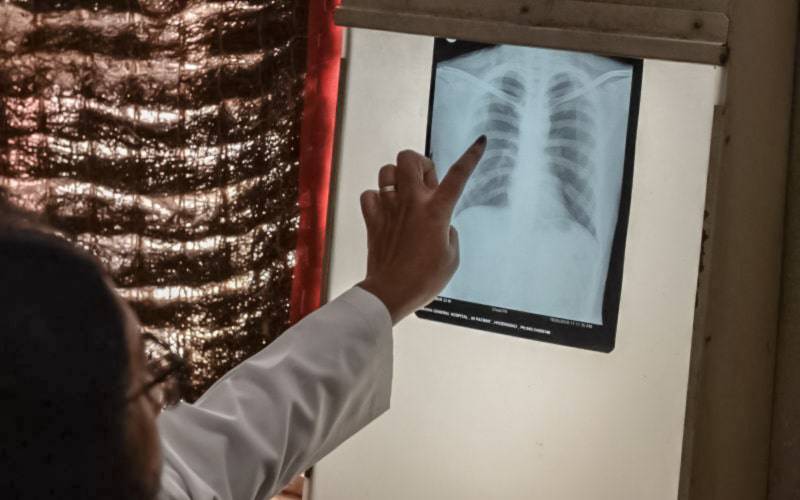 Tuberculose mantém tendência decrescente em Portugal