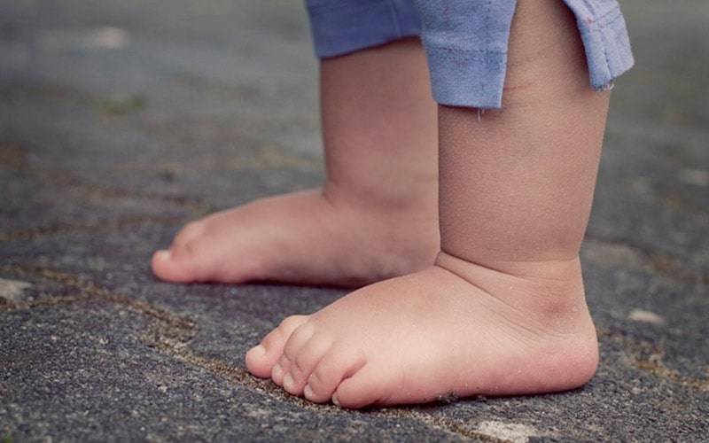 Podologistas alertam para deformidades dos pés das crianças