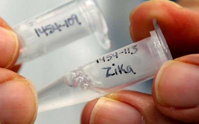Cientistas descobrem como vírus Zika escapa ao sistema imunológico