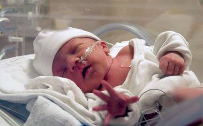 COVID-19 não foi associada a aumento de nascimentos de prematuros