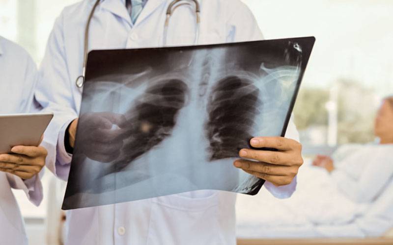 Há um potencial tratamento para a lesão pulmonar aguda