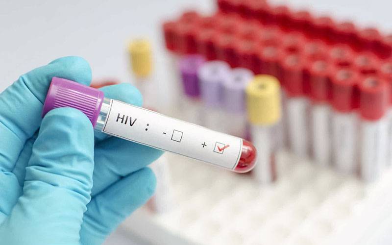 HIV Meeting Point 2021 vai debater a atualidade na área do VIH