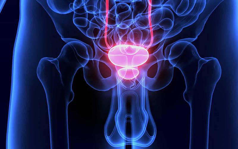 Próstata: nova técnica destrói células cancerígenas em minutos