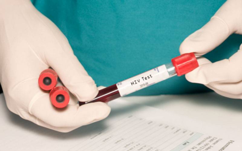 Semana Europeia do Teste do VIH-Hepatites novembro 2021